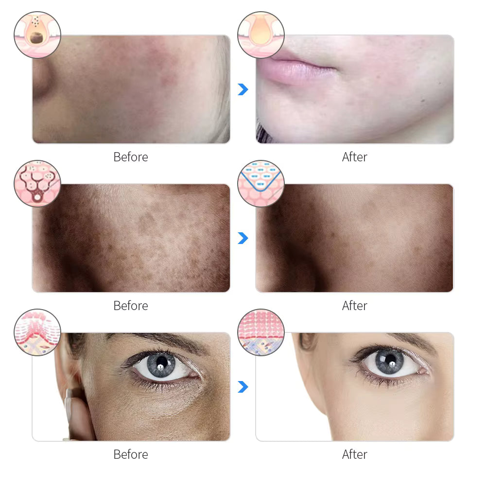 LumiMask Pro™ – 7-Colour LED Light Therapy Face Mask